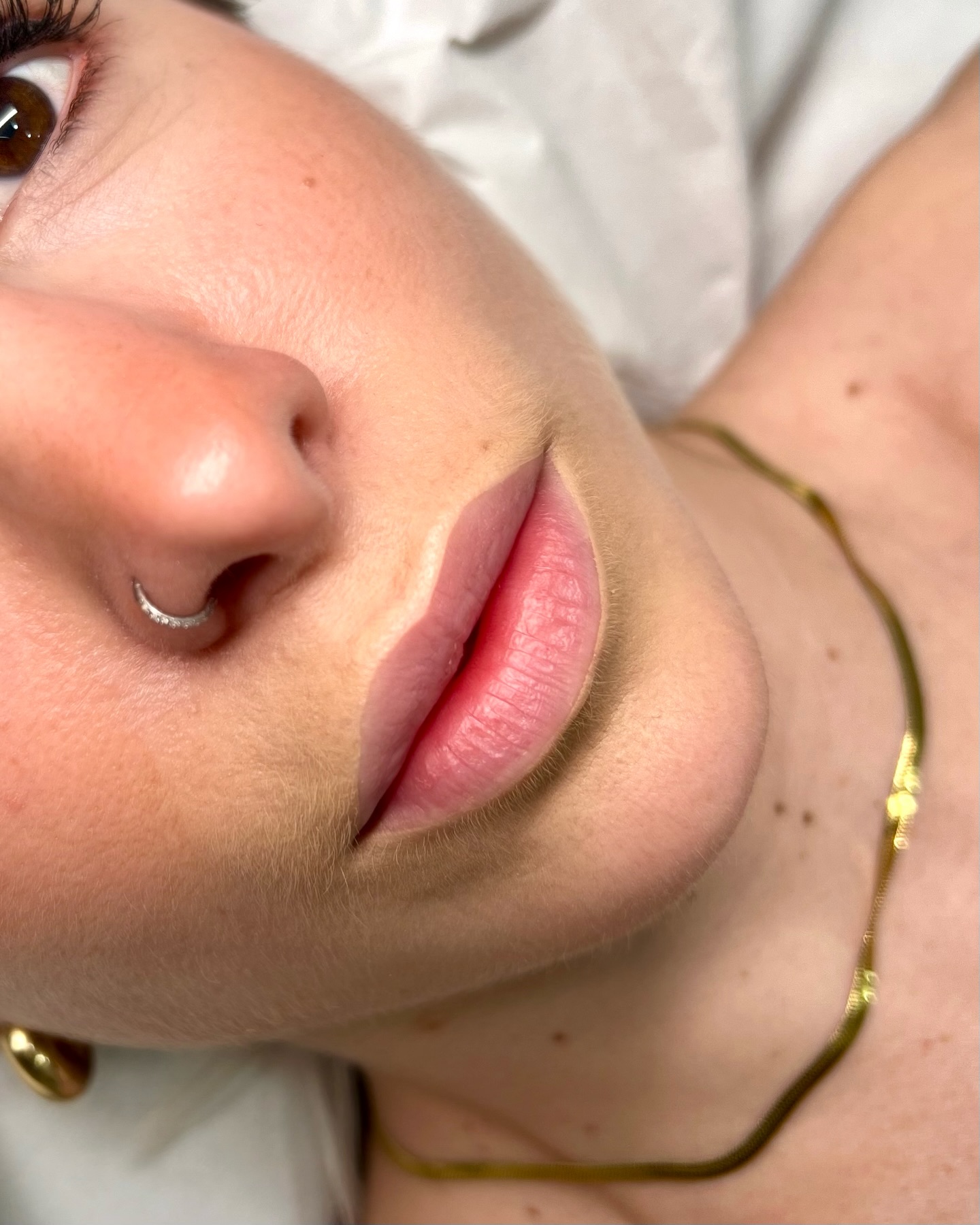 Estetica facial